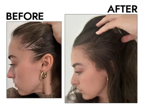 Beautyline Lissia Tónico capilar control caida minoxidil 2%